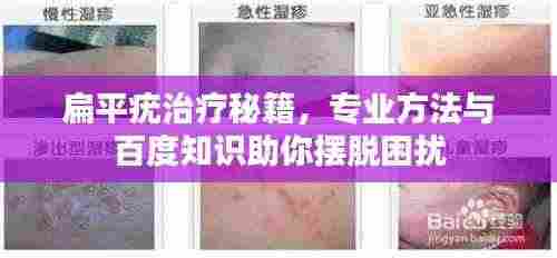 扁平疣治疗秘籍,专业方法与百度知识助你摆脱困扰