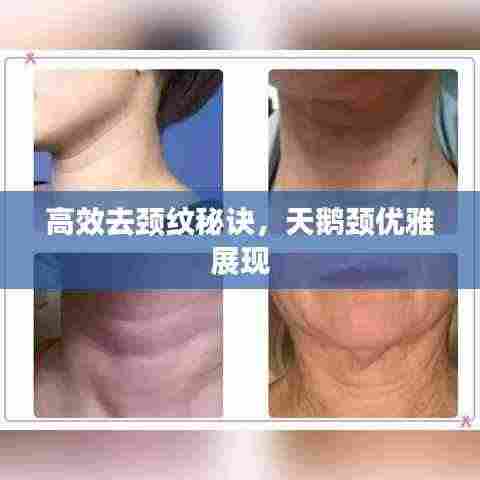高效去颈纹秘诀，天鹅颈优雅展现